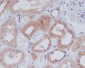 Anti-AMPK alpha 1 PRKAA1 Rabbit Monoclonal Antibody